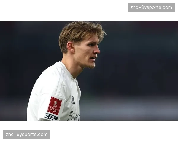 阿森纳厄德高萨利巴恢复进度待评估 次回合主场作战存变数